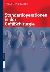 Standardoperationen in der Gefäßchirurgie -  Johannes Frömke