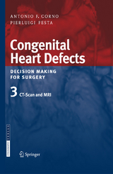 Congenital Heart Defects. Decision Making for Surgery - Antonio F. Corno, Pierluigi Festa