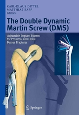 The Double Dynamic Martin Screw (DMS) - 