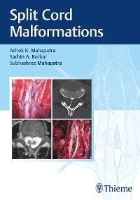Split Cord Malformations -  Sachin A. Borkar,  Ashok K. Mahapatra,  Subhashree Mahapatra