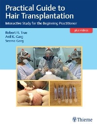 Practical Guide to Hair Transplantation -  Anil K. Garg,  Seema Garg,  Roberth H. True