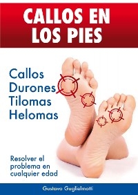 CALLOS EN LOS PIES - Solución definitiva para Callos, Tilomas y Helomas. - Gustavo Guglielmotti