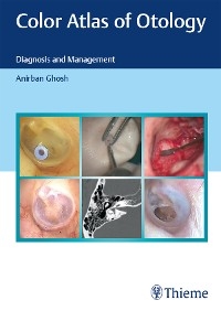 Color Atlas of Otology -  Anirban Ghosh