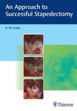 Approach to Successful Stapedectomy -  B. M. Gupta