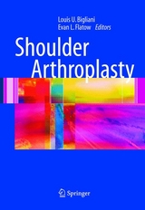 Shoulder Arthroplasty - 
