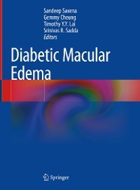 Diabetic Macular Edema - 