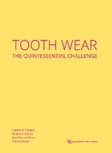 Tooth Wear - Débora R. Vilaboa, Beatriz R. Vilaboa, Jose Manuel Reuss, Débora Reuss