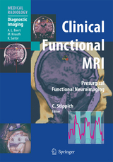 Clinical Functional MRI - 