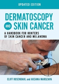 Dermatoscopy and Skin Cancer, updated edition -  Aksana Marozava,  Cliff Rosendahl