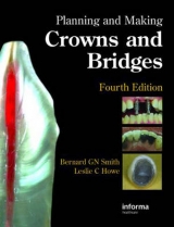 Planning and Making Crowns and Bridges - Smith, Bernard G. N.; Howe, Leslie C.