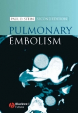 Pulmonary Embolism - Stein