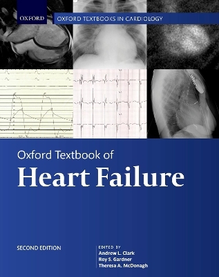 Oxford Textbook of Heart Failure - 