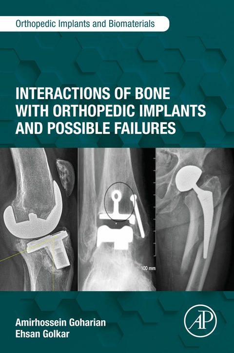 Interactions of Bone with Orthopedic Implants and Possible Failures -  Amirhossein Goharian,  Ehsan Golkar