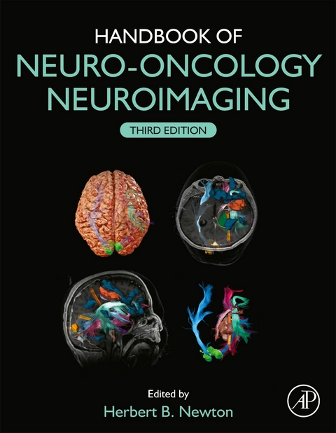 Handbook of Neuro-Oncology Neuroimaging - 