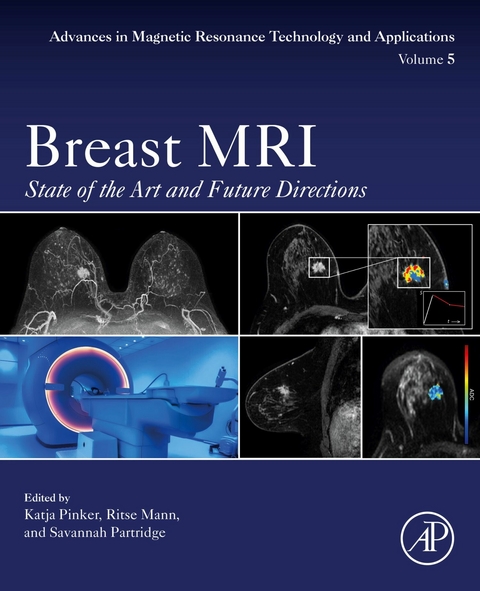 Breast MRI - 