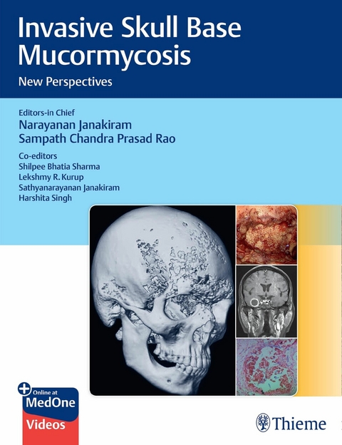 Invasive Skull Base Mucormycosis - 