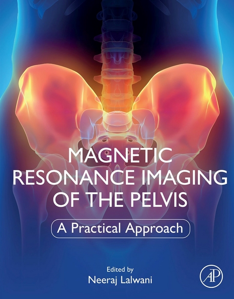 Magnetic Resonance Imaging of The Pelvis - 