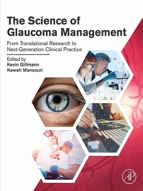 Science of Glaucoma Management - 