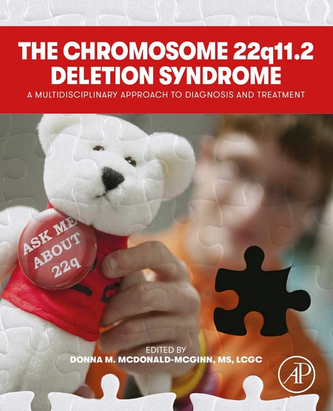 Chromosome 22q11.2 Deletion Syndrome - 