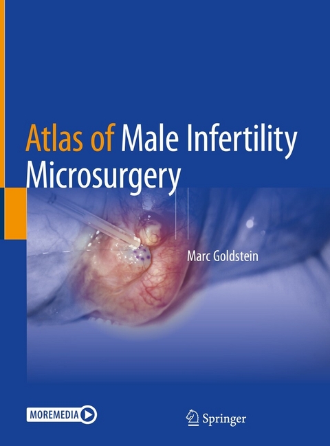 Atlas of Male Infertility Microsurgery -  Marc Goldstein