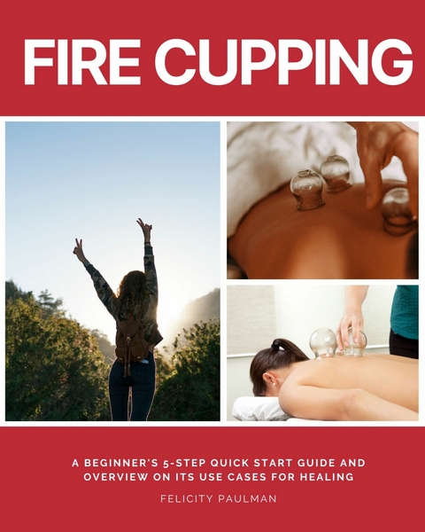 Fire Cupping -  Felicity Paulman