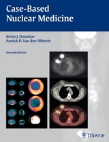 Case-Based Nuclear Medicine - Donohoe, Kevin J.; Van den Abbeele, Annick D.