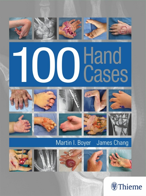 100 Hand Cases -  Martin Boyer,  James Chang
