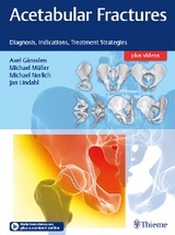 Acetabular Fractures - 