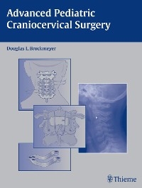 Advanced Pediatric Craniocervical Surgery - 