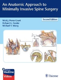 Anatomic Approach to Minimally Invasive Spine Surgery - 