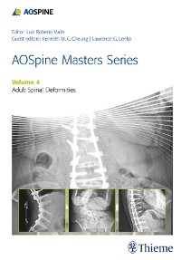 AOSpine Masters Series, Volume 4: Adult Spinal Deformities - 