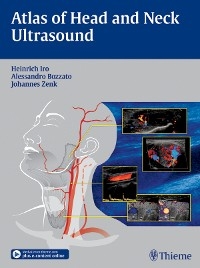 Atlas of Head and Neck Ultrasound - Heinrich Iro, Alessandro Bozzato, Johannes Zenk