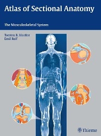 Atlas of Sectional Anatomy - Torsten Bert Möller, Emil Reif