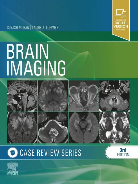 Brain Imaging: Case Review Series -  Laurie A. Loevner,  Suyash Mohan
