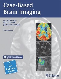 Case-Based Brain Imaging -  Joseph Comunale,  Pina C. Sanelli,  A. John Tsiouris