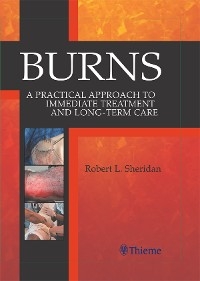 Burns -  Robert Sheridan