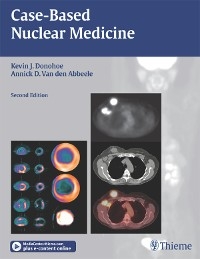 Case-Based Nuclear Medicine - 