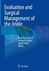 Evaluation and Surgical Management of the Ankle - 