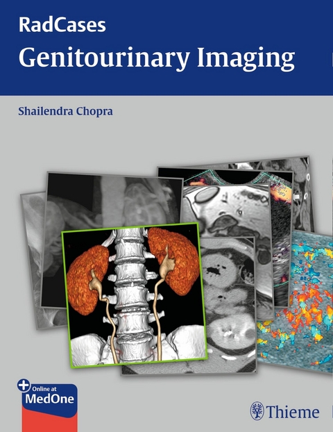 Radcases Genitourinary Imaging -  Shailendra Chopra