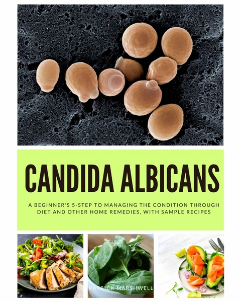 Candida Albicans -  Patrick Marshwell