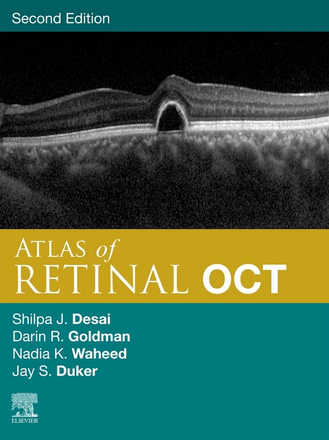 Atlas of Retinal OCT E-Book - 