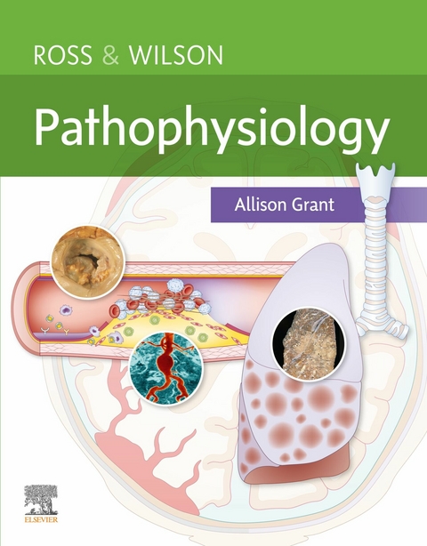 Ross & Wilson Pathophysiology E-Book -  Allison Grant