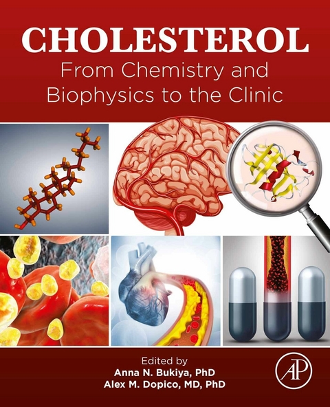 Cholesterol - 