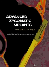 Advanced Zygomatic Implants -  Carlos Aparicio