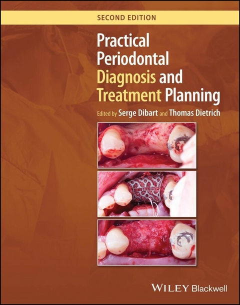 Practical Periodontal Diagnosis and Treatment Planning - 