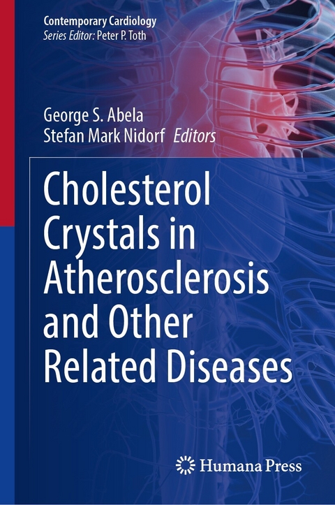 Cholesterol Crystals in Atherosclerosis and Other Related Diseases - 