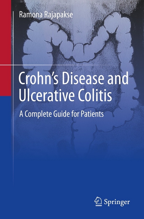 Crohn's Disease and Ulcerative Colitis - Ramona Rajapakse