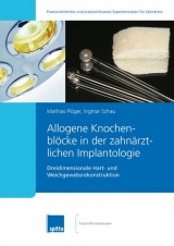 Allogene Knochenblöcke in der zahnärztlichen Implantologie - Mathias Plöger, Ingmar Schau