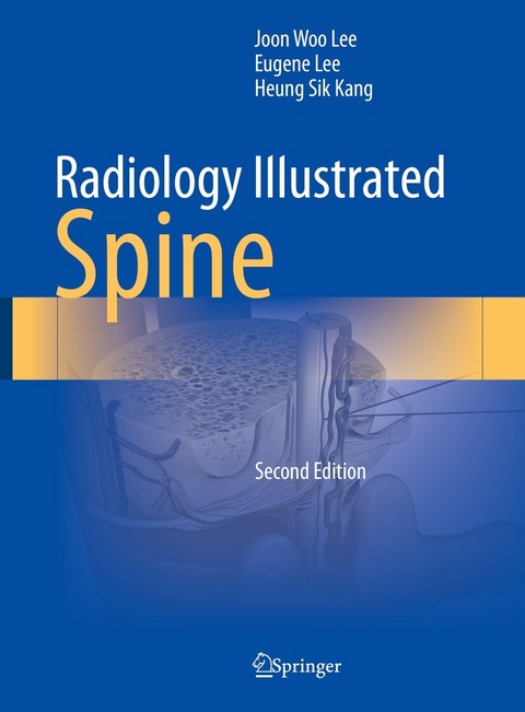 Radiology Illustrated: Spine - Joon Woo Lee, Eugene Lee, Heung Sik Kang