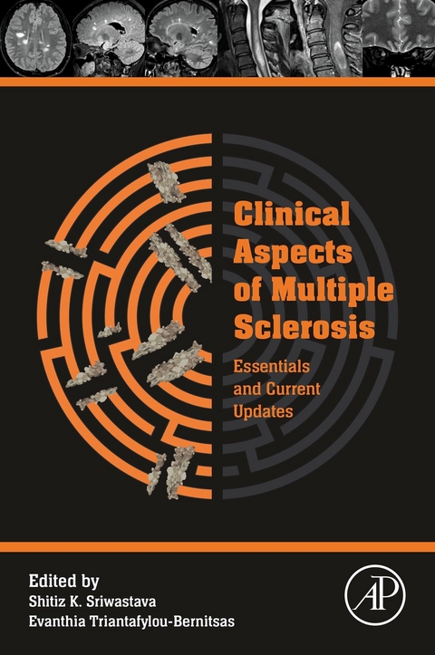 Clinical Aspects of Multiple Sclerosis Essentials and Current Updates - 